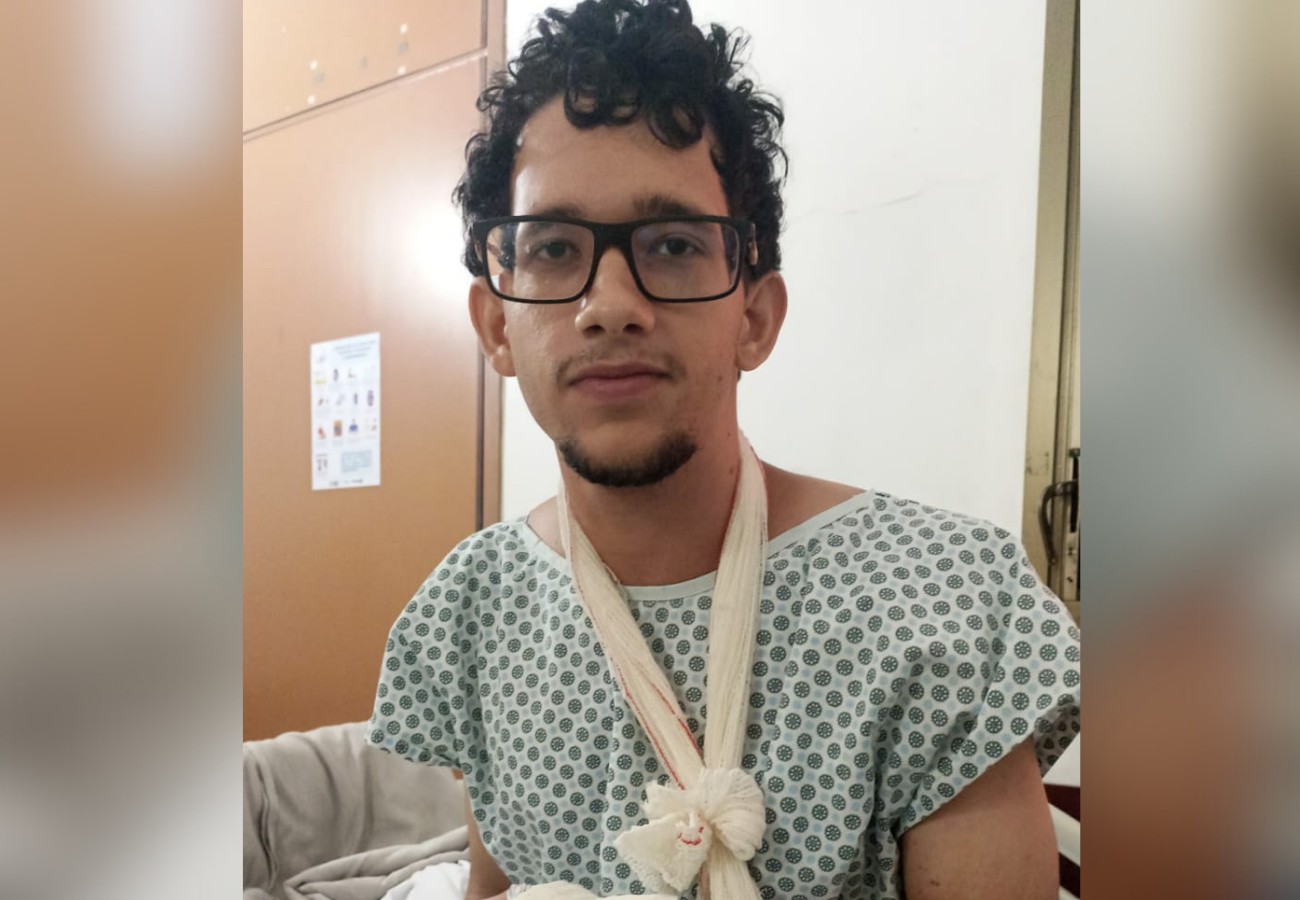 Jovem ferido por explosão de bolo em sua festa de aniversário ficará um mês em tratamento antes de fisioterapia, diz mãe