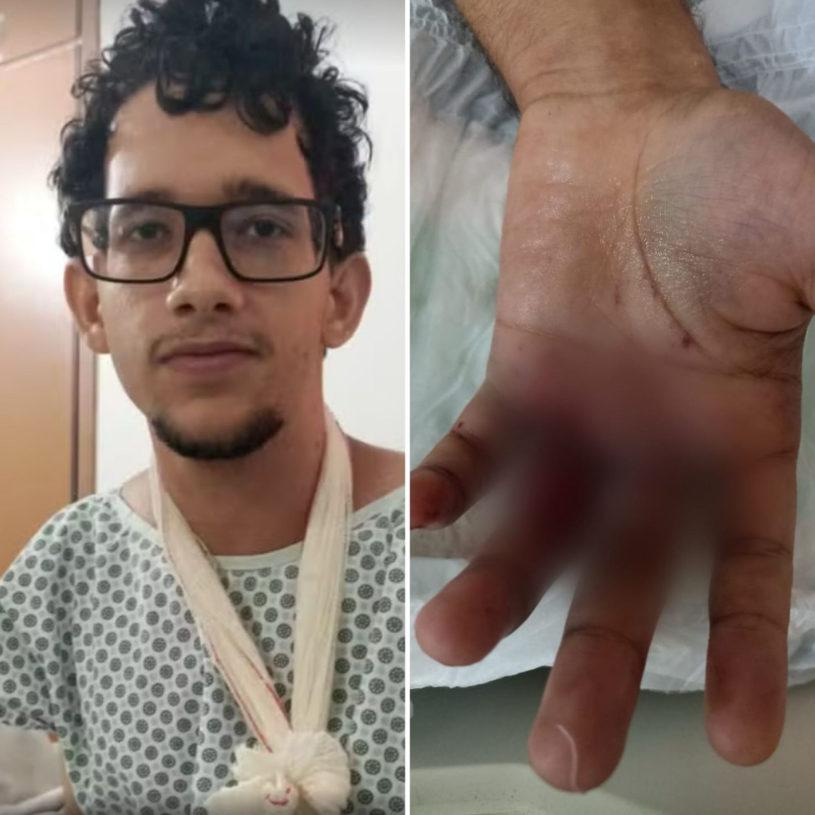 Bombinha ‘surpresa’ e investigação: o que se sabe sobre explosão de bolo que deixou jovem ferido em festa de aniversário